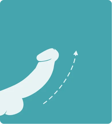 Technology Step 1